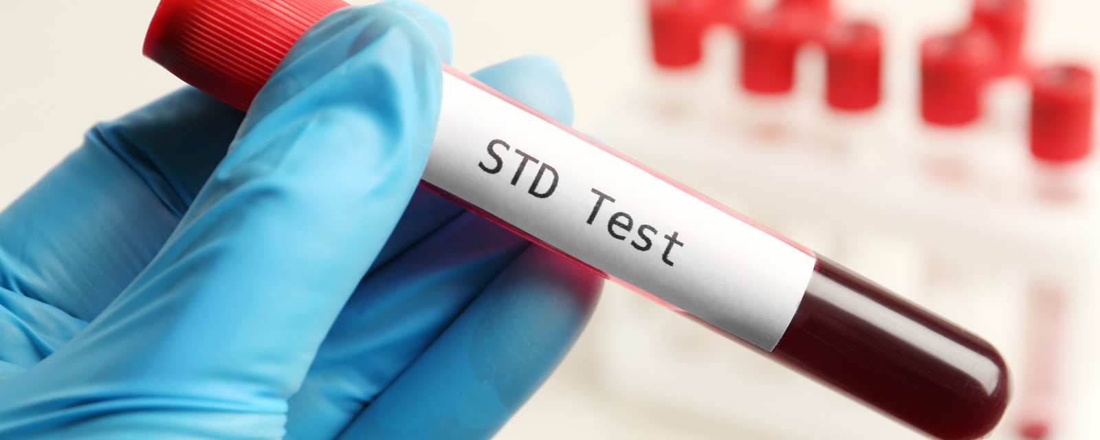 STI blood test sample