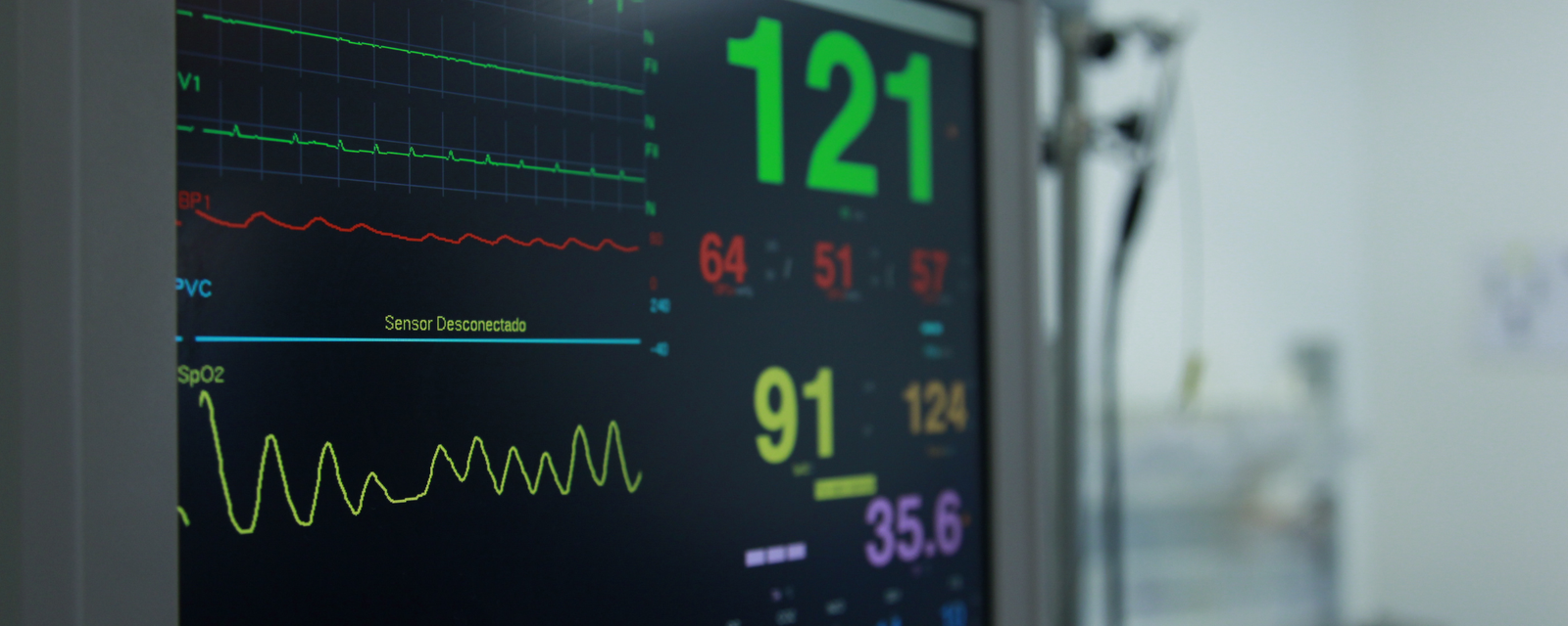 ECG cardiac monitor showing heart rhythm